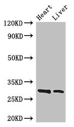 Western Blot  | Positive WB detected in: Mouse heart tissue, Mouse liver tissue  | All lanes: SPIC antibody at 3.4µg/ml  | Secondary  | Goat polyclonal to rabbit IgG at 1/50000 dilution  | Predicted band size: 30 kDa  | Observed band size: 30 kDa