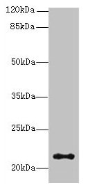 Western blot  | All lanes: JAGN1 antibody at 3µg/ml + HL60 whole cell lysate  | Secondary  | Goat polyclonal to rabbit IgG at 1/10000 dilution  | Predicted band size: 22 kDa  | Observed band size: 22 kDa