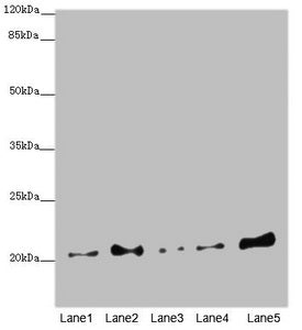 Western blot  | All lanes: COMMD1 antibody at 5.36µg/ml  | Lane 1: A549 whole cell lysate  | Lane 2: Jurkat whole cell lysate  | Lane 3: MCF-7 whole cell lysate  | Lane 4: Hela whole cell lysate  | Lane 5: HepG2 whole cell lysate  | Secondary  | Goat polyclonal to rabbit IgG at 1/10000 dilution  | Predicted band size: 22, 18 kDa  | Observed band size: 22 kDaRabbit anti-Human COMMD1 Polyclonal Antibody