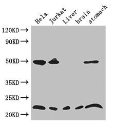 Western Blot | Positive WB detected in: Hela whole cell lysate, Jurkat whole cell lysate, Mouse liver tissue, Mouse brain tissue, Mouse stomach tissue | All lanes: COMMD1 antibody at 3.4μg/ml | Secondary | Goat polyclonal to rabbit IgG at 1/50000 dilution | Predicted band size: 22, 18 kDa | Observed band size: 22, 50 kDaRabbit anti-Human COMMD1 Polyclonal Antibody