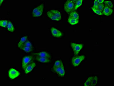 Immunofluorescence staining of HepG2 cells with ATP6V0D2 Antibody at 1:166, counter-stained with DAPI. The cells were fixed in 4% formaldehyde, permeabilized using 0.2% Triton X-100 and blocked in 10% normal Goat Serum. The cells were then incubated with the antibody overnight at 4°C. The secondary antibody was Alexa Fluor 488-congugated AffiniPure Goat Anti-Rabbit IgG(H+L).