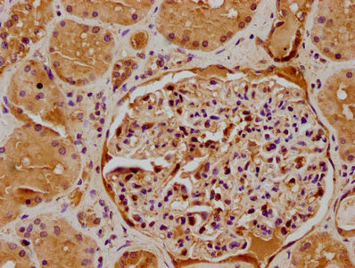 IHC image of ATP6V0D2 Antibody diluted at 1:500 and staining in paraffin-embedded human kidney tissue performed on a Leica BondTM system. After dewaxing and hydration, antigen retrieval was mediated by high pressure in a citrate buffer (pH 6.0). Section was blocked with 10% normal goat serum 30min at RT. Then primary antibody (1% BSA) was incubated at 4°C overnight. The primary is detected by a biotinylated secondary antibody and visualized using an HRP conjugated SP system.