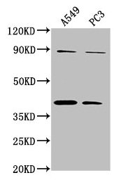 Western Blot  | Positive WB detected in: A549 whole cell lysate, PC3 whole cell lysate  | All lanes: ATP6V0D2 antibody at 1:2000  | Secondary  | Goat polyclonal to rabbit IgG at 1/50000 dilution  | Predicted band size: 41 kDa  | Observed band size: 41 kDa