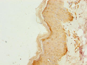 Immunohistochemistry of paraffin-embedded human skin tissue using CCDC89 Antibody at dilution of 1:100