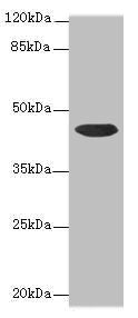 Western blot  | All lanes: CCDC89 antibody at 1.7µg/ml + Mouse kidney tissue  | Secondary  | Goat polyclonal to rabbit IgG at 1/10000 dilution  | Predicted band size: 44 kDa  | Observed band size: 44 kDa