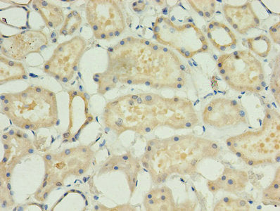 Immunohistochemistry of paraffin-embedded human kidney tissue using ACBD4 Antibody at dilution of 1:100