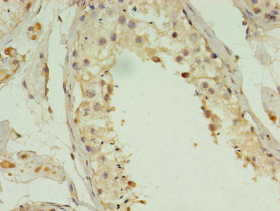 Immunohistochemistry of paraffin-embedded human testis tissue using ACBD4 Antibody at dilution of 1:100
