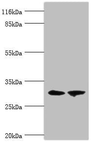 Western blot  | All lanes: ACBD4 antibody at 2µg/ml  | Lane 1: Mouse kidney tissue  | Lane 2: Mouse liver tissue  | Secondary  | Goat polyclonal to rabbit IgG at 1/10000 dilution  | Predicted band size: 31, 35, 38 kDa  | Observed band size: 31 kDa