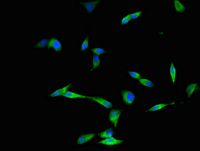 Immunofluorescent analysis of Hela cells using DYNC2H1 Antibody at dilution of 1:100 and Alexa Fluor 488-congugated AffiniPure Goat Anti-Rabbit IgG(H+L)