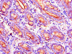 Immunohistochemistry of paraffin-embedded human small intestine tissue using DYNC2H1 Antibody at dilution of 1:100