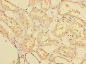 Immunohistochemistry of paraffin-embedded human kidney tissue using CCDC112 Antibody at dilution of 1:100
