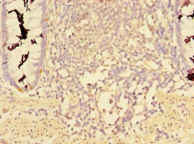 Immunohistochemistry of paraffin-embedded human colon tissue using CCDC112 Antibody at dilution of 1:100