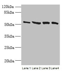 Western blot  | All lanes: CCDC112 antibody at 12µg/ml  | Lane 1: Jurkat whole cell lysate  | Lane 2: Hela whole cell lysate  | Lane 3: HepG2 whole cell lysate  | Lane 4: A549 whole cell lysate  | Secondary  | Goat polyclonal to rabbit IgG at 1/10000 dilution  | Predicted band size: 54, 62 kDa  | Observed band size: 54 kDa