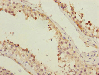 Immunohistochemistry of paraffin-embedded human testis tissue using SUPT20H Antibody at dilution of 1:100Rabbit anti-Human SUPT20H Polyclonal Antibody