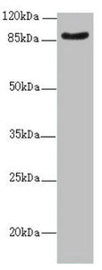 Western blot | All lanes: SUPT20H antibody at 2.07μg/ml + Mouse kidney tissue | Secondary | Goat polyclonal to rabbit IgG at 1/10000 dilution | Predicted band size: 86, 81, 89 kDa | Observed band size: 86 kDaRabbit anti-Human SUPT20H Polyclonal Antibody