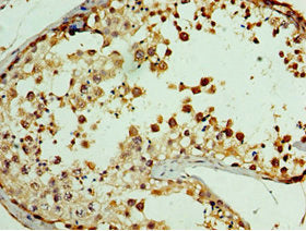 Immunohistochemistry of paraffin-embedded human testis tissue using GPRC5A Antibody at dilution of 1:100Rabbit anti-Human GPRC5A Polyclonal Antibody