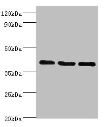 Western blot | All lanes: GPRC5A antibody at 8μg/ml | Lane 1: Hela whole cell lysate | Lane 2: HepG2 whole cell lysate | Lane 3: MCF-7 whole cell lysate | Secondary | Goat polyclonal to rabbit IgG at 1/10000 dilution | Predicted band size: 40 kDa | Observed band size: 40 kDaRabbit anti-Human GPRC5A Polyclonal Antibody