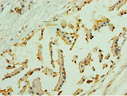 Immunohistochemistry of paraffin-embedded human prostate tissue using NLGN4Y Antibody at dilution of 1:100Rabbit anti-Human NLGN4Y Polyclonal Antibody