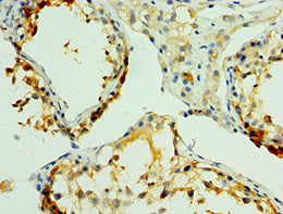 Immunohistochemistry of paraffin-embedded human testis tissue using NLGN4Y Antibody at dilution of 1:100Rabbit anti-Human NLGN4Y Polyclonal Antibody