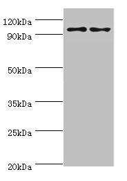 Western blot | All lanes: NLGN4Y antibody at 6μg/ml | Lane 1: A549 whole cell lysate | Lane 2: Mouse brain tissue | Secondary | Goat polyclonal to rabbit IgG at 1/10000 dilution | Predicted band size: 93, 73, 16, 29 kDa | Observed band size: 93 kDaRabbit anti-Human NLGN4Y Polyclonal Antibody