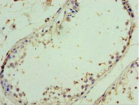 Immunohistochemistry of paraffin-embedded human testis tissue using AIMP2 Antibody at dilution of 1:100Rabbit anti-Human AIMP2 Polyclonal Antibody