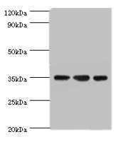 Western blot | All lanes: AIMP2 antibody at 5μg/ml | Lane 1: Hela whole cell lysate | Lane 2: HepG2 whole cell lysate | Lane 3: K562 whole cell lysate | Secondary | Goat polyclonal to rabbit IgG at 1/10000 dilution | Predicted band size: 35 kDa | Observed band size: 35 kDaRabbit anti-Human AIMP2 Polyclonal Antibody