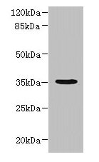 Western blot  | All lanes: NUBPL antibody at 1µg/ml + A431 whole cell lysate  | Secondary  | Goat polyclonal to rabbit IgG at 1/10000 dilution  | Predicted band size: 35, 19 kDa  | Observed band size: 35 kDaRabbit anti-Human NUBPL Polyclonal Antibody