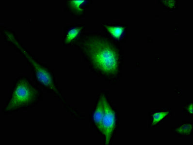 Immunofluorescence staining of U251 cells with PIP4K2C Antibody at 1:100, counter-stained with DAPI. The cells were fixed in 4% formaldehyde, permeabilized using 0.2% Triton X-100 and blocked in 10% normal Goat Serum. The cells were then incubated with the antibody overnight at 4°C. The secondary antibody was Alexa Fluor 488-congugated AffiniPure Goat Anti-Rabbit IgG(H+L).Rabbit anti-Human PIP4K2C Polyclonal Antibody