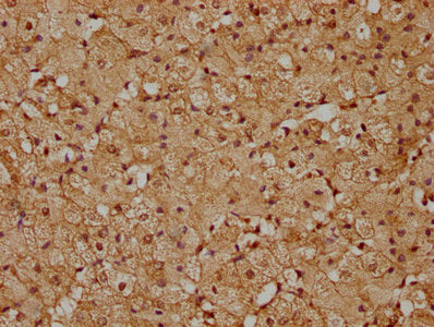 IHC image of the antibody diluted at 1:200 and staining in paraffin-embedded human adrenal gland tissue performed on a Leica BondTM system. After dewaxing and hydration, antigen retrieval was mediated by high pressure in a citrate buffer (pH 6.0). Section was blocked with 10% normal goat serum 30min at RT. Then primary antibody (1% BSA) was incubated at 4°C overnight. The primary is detected by a biotinylated secondary antibody and visualized using an HRP conjugated SP system.Rabbit anti-Human PIP4K2C Polyclonal Antibody