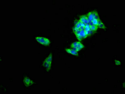 Immunofluorescence staining of 293 cells with GPBAR1 Antibody at 1:100, counter-stained with DAPI. The cells were fixed in 4% formaldehyde, permeabilized using 0.2% Triton X-100 and blocked in 10% normal Goat Serum. The cells were then incubated with the antibody overnight at 4°C. The secondary antibody was Alexa Fluor 488-congugated AffiniPure Goat Anti-Rabbit IgG(H+L).Rabbit anti-Human GPBAR1 Polyclonal Antibody