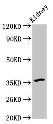 Western BlotPositive WB detected in: Mouse kidney tissueAll lanes: GPBAR1 antibody at 6μg/mlSecondaryGoat polyclonal to rabbit IgG at 1/50000 dilutionPredicted band size: 36 kDaObserved band size: 36 kDaRabbit anti-Human GPBAR1 Polyclonal Antibody