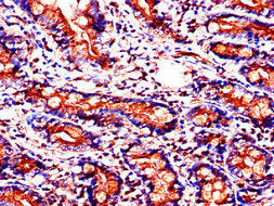 Immunohistochemistry of paraffin-embedded human small intestine tissue using SLC37A2 Antibody at dilution of 1:100Rabbit anti-Human SLC37A2 Polyclonal Antibody