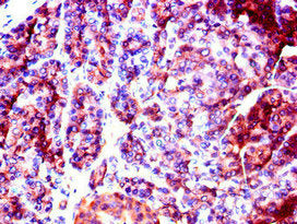 Immunohistochemistry of paraffin-embedded human pancreatic tissue using SLC37A2 Antibody at dilution of 1:100Rabbit anti-Human SLC37A2 Polyclonal Antibody