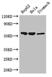 Western Blot | Positive WB detected in: HepG2 whole cell lysate, Hela whole cell lysate, Mouse stomach tissue | All lanes: SLC37A2 antibody at 3μg/ml | Secondary | Goat polyclonal to rabbit IgG at 1/50000 dilution | Predicted band size: 55, 43, 14 kDa | Observed band size: 55 kDaRabbit anti-Human SLC37A2 Polyclonal Antibody