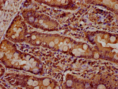 IHC image of PARD3 Antibody diluted at 1:600 and staining in paraffin-embedded human small intestine tissue performed on a Leica BondTM system. After dewaxing and hydration, antigen retrieval was mediated by high pressure in a citrate buffer (pH 6.0). Section was blocked with 10% normal goat serum 30min at RT. Then primary antibody (1% BSA) was incubated at 4°C overnight. The primary is detected by a biotinylated secondary antibody and visualized using an HRP conjugated SP system.Rabbit anti-Human PARD3 Polyclonal Antibody