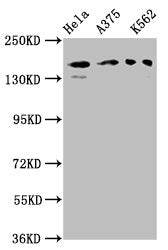Western Blot  | Positive WB detected in: Hela whole cell lysate, A375 whole cell lysate, K562 whole cell lysate  | All lanes: PARD3 antibody at 3µg/ml  | Secondary  | Goat polyclonal to rabbit IgG at 1/50000 dilution  | Predicted band size: 152, 142, 147, 139, 114, 109, 110, 150 kDa  | Observed band size: 152 kDaRabbit anti-Human PARD3 Polyclonal Antibody