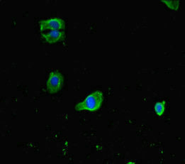 Immunofluorescent analysis of HepG2 cells using FNIP1 Antibody at dilution of 1:100 and Alexa Fluor 488-congugated AffiniPure Goat Anti-Rabbit IgG(H+L)Rabbit anti-Human FNIP1 Polyclonal Antibody
