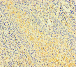 Immunohistochemistry of paraffin-embedded human tonsil tissue using the antibody at dilution of 1:100Rabbit anti-Human FNIP1 Polyclonal Antibody