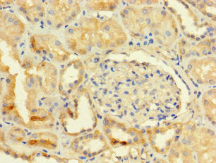 Immunohistochemistry of paraffin-embedded human kidney tissue using TMEM255B Antibody at dilution of 1:100Rabbit anti-Human TMEM255B Polyclonal Antibody