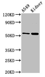Western Blot  | Positive WB detected in: A549 whole cell lysate, Rat kidney tissue  | All lanes: AFG1L antibody at 3µg/ml  | Secondary  | Goat polyclonal to rabbit IgG at 1/50000 dilution  | Predicted band size: 55 kDa  | Observed band size: 55 kDa