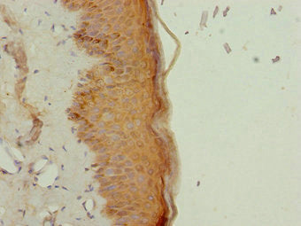 Immunohistochemistry of paraffin-embedded human skin tissue using NR2E1 Antibody at dilution of 1:100Rabbit anti-Human NR2E1 Polyclonal Antibody