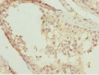 Immunohistochemistry of paraffin-embedded human testis tissue using NR2E1 Antibody at dilution of 1:100Rabbit anti-Human NR2E1 Polyclonal Antibody