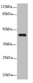 Western blot | All lanes: NR2E1antibody at 3.2μg/ml + Mouse brain tissue | Secondary | Goat polyclonal to rabbit IgG at 1/10000 dilution | Predicted band size: 43, 47 kDa | Observed band size: 43 kDaRabbit anti-Human NR2E1 Polyclonal Antibody
