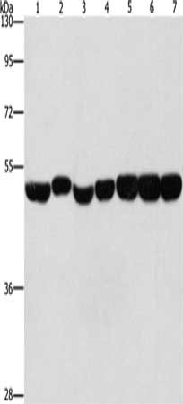 Gel: 8%SDS-PAGE, Lysate: 40 μg, Lane 1-7: Hela cells, A431 cells, hepG2 cells, mouse brain tissue, Mouse liver tissue, mouse pancreas tissue, human fetal brain tissue, Primary antibody: ENO1 Antibody(ENO1 Antibody) at dilution 1/700, Secondary antibody: Goat anti rabbit IgG at 1/8000 dilution, Exposure time: 10 secondsRabbit anti-Human ENO1 Polyclonal Antibody