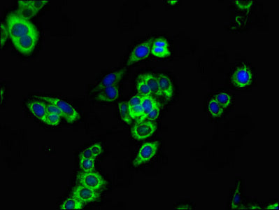 Immunofluorescent analysis of HepG2 cells using CPT1B Antibody at dilution of 1:100 and Alexa Fluor 488-congugated AffiniPure Goat Anti-Rabbit IgG(H+L)Rabbit anti-Human CPT1B Polyclonal Antibody