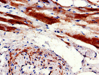 Immunohistochemistry of paraffin-embedded human heart tissue using CPT1B Antibody at dilution of 1:100Rabbit anti-Human CPT1B Polyclonal Antibody