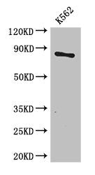 Western Blot | Positive WB detected in: K562 whole cell lysate | All lanes: CPT1B antibody at 3.4μg/ml | Secondary | Goat polyclonal to rabbit IgG at 1/50000 dilution | Predicted band size: 88, 67, 84, 79 kDa | Observed band size: 88 kDaRabbit anti-Human CPT1B Polyclonal Antibody