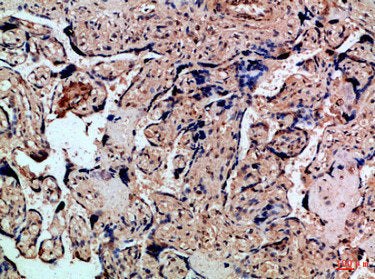 Immunohistochemical analysis of paraffin-embedded Human-placenta, antibody was diluted at 1:100Rabbit anti-Human CXCR1 Polyclonal Antibody