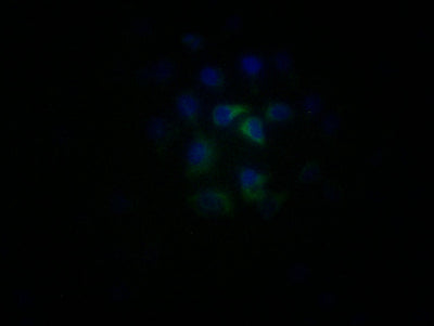 Immunofluorescence staining of MCF-7 cells with CR1 Antibody at 1:25, counter-stained with DAPI. The cells were fixed in 4% formaldehyde, permeabilized using 0.2% Triton X-100 and blocked in 10% normal Goat Serum. The cells were then incubated with the antibody overnight at 4°C. The secondary antibody was Alexa Fluor 488-congugated AffiniPure Goat Anti-Rabbit IgG(H+L).Rabbit anti-Human CR1 Polyclonal Antibody