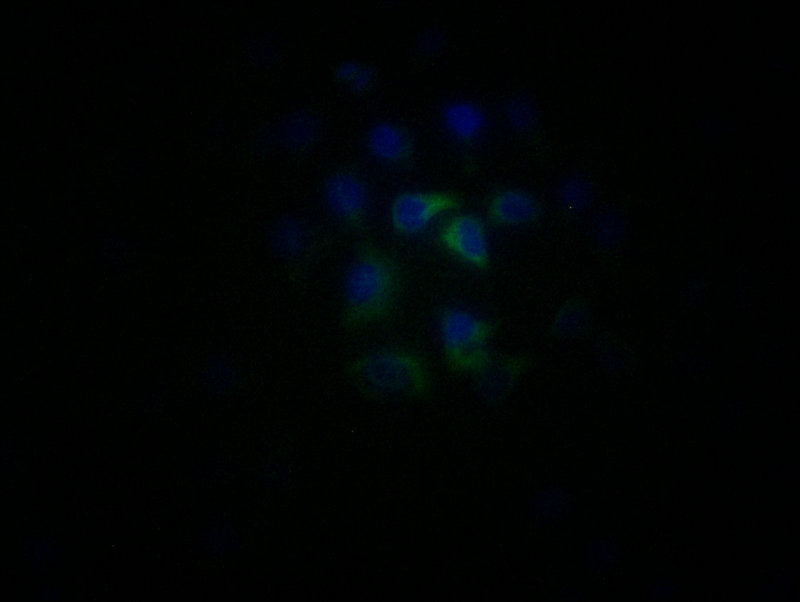 Immunofluorescence staining of MCF-7 cells with CR1 Antibody at 1:25, counter-stained with DAPI. The cells were fixed in 4% formaldehyde, permeabilized using 0.2% Triton X-100 and blocked in 10% normal Goat Serum. The cells were then incubated with the antibody overnight at 4°C. The secondary antibody was Alexa Fluor 488-congugated AffiniPure Goat Anti-Rabbit IgG(H+L).Rabbit anti-Human CR1 Polyclonal Antibody